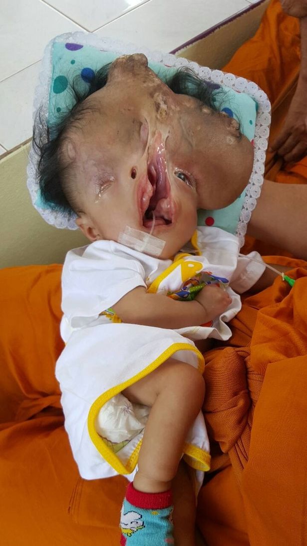 PAY-Severely-disabled-baby-gets-help (4)