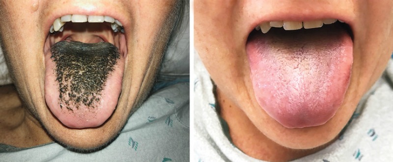 Желіде қара әйелдің аузында