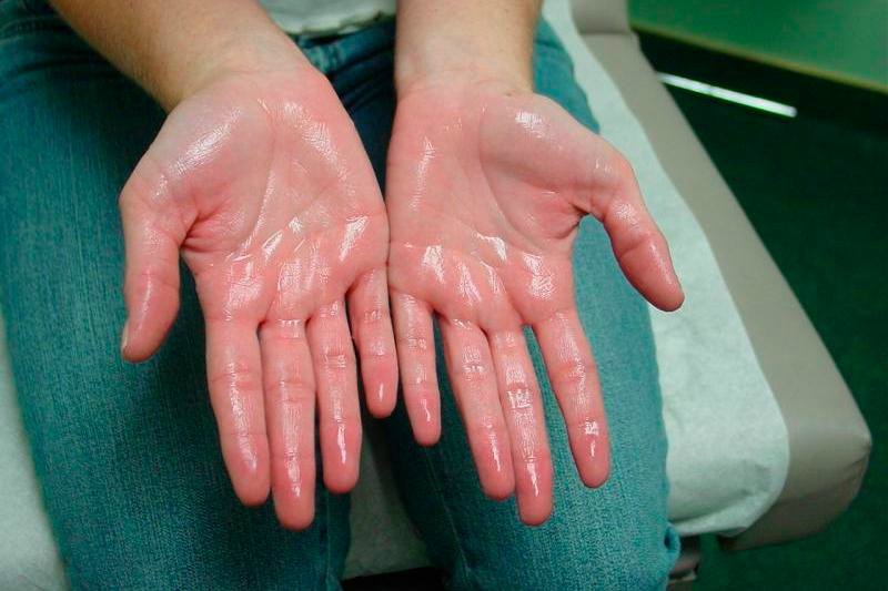 Телефонда жұтынып жатқан консело