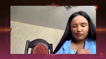 "Көп адам жаман пікірлер жазады": Жарты беті күйіп қалған Әсел Сүлейменова эфирде жылап қалды