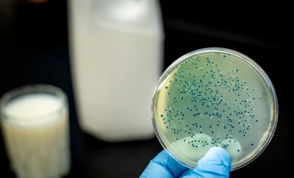 Қостанай облысында 21 адам бруцеллез жұқтырған, оның төртеуі бала