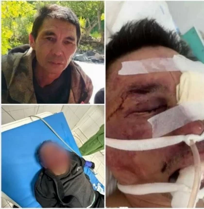 "14 қабырғасын сындырған": Алматы облысында елу жастағы ер адамды аяусыз соққыға жыққан үш жасөспірім әлі бостандықта жүр 