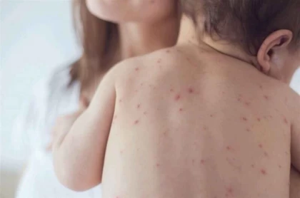 Антиваксер ата-ана ауырған баланың емін төлеп беруі тиіс: Қоғам белсенділері балаларға міндетті екпе салуға қатысты заңды қатаңдатуды талап етті