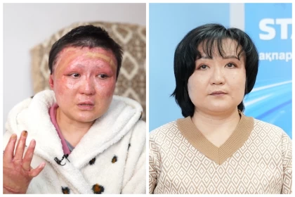 Бір жыл бұрын күйеуі өртеп жіберген алматылық әйел дәл қазіргі ауыр жағдайын айтты