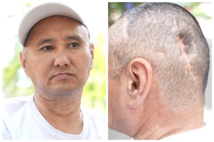 "Бір досым ғана қалды": Қаңтар оқиғасында алаңға ту көтеріп шығып, басына оқ тиген Берік Әбішев қазіргі жағдайын айтты