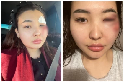 "Молаға апарып, қорлады": Қазақстандық блогер өзін ұрлап әкетіп, ұрып-соққанын мәлімдеді