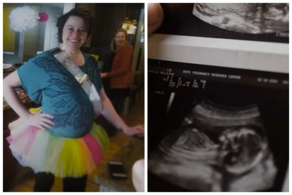 "Ішін кесіп, 7 айлық шарананы алып қашқан": Жүкті әйел өзіне шабуылдаған қылмыскердің кесірінен сәбиінен айырылғанын айтты