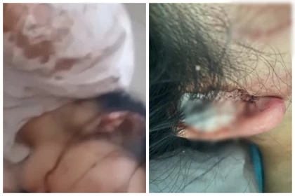 Шымкентте қыз зорлыққа ұшырады: Сот-медициналық сараптама жәбірленушінің денесіндегі ауыр жарақатты "жеңіл" деп бағалаған (видео)