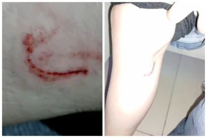 Көкшетауда 15 жастағы қызды иттер талап тастады (видео)