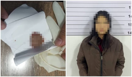 Қыз сүйісу кезінде жігітінің тілін тістеп, жұлып алған