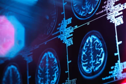 Ғалымдар адамның миы 30 жастан кейін ғана толық қалыптасатынын анықтады