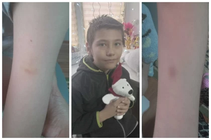 Ақтөбелік келіншек мүгедек ұлының ауруханада соққыға жығылғанын мәлімдеді