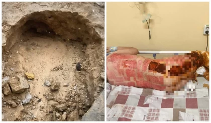 Ақтауда жылу құбырының жарылуынан бір баланы күйік шалып, мүгедек болып қалды