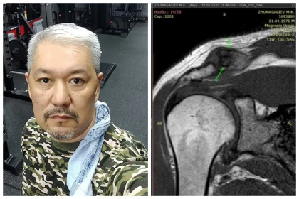 "Қолымнан айырылып қалу алдында тұрмын": МӘМС арқылы уақытылы көмек ала алмаған қазақстандық ота кезегінің ұзаққа созылғанына наразы