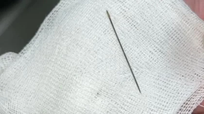 Қазақстанда 8 айлық сәбидің ішінен ине табылды