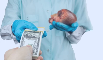 Алимент бойынша қарызын төлеу үшін қазақстандық ер адам бүйрегін сатпақ болған