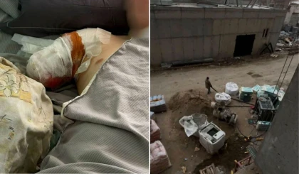 Қауіпсіздік талаптары сақталмаған: Семейде 20 жастағы құрылысшы жігіт қолынан айырылды