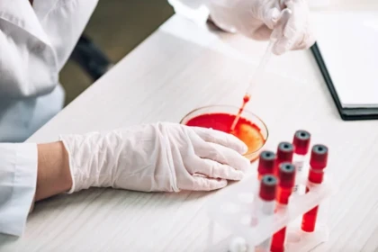 Еуропада өлімге әкелуі мүмкін қауіпті инфекция тарала бастады