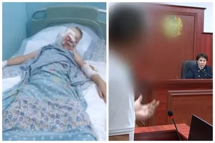 Қаскелеңде 11 жасар балаға бірнеше ит шабуыл жасаған: Жануарлардың иесі сотқа тартылды