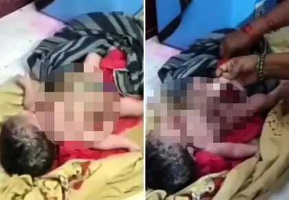 Төрт қолы мен төрт аяғы бар сәби дүниеге келді