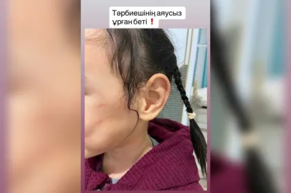 Астаналық әйел жекеменшік балабақша қызметкерін баланы ұрып-соқты деп айыптады