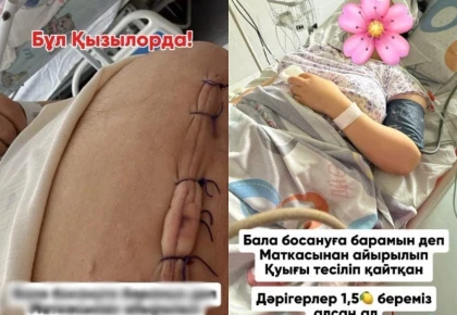 Қызылордада дәрігерлер әйелге кесарь тілігін жасаған кезде қуығын тесіп алған: Ол бес ай бойы жөргек киіп жүр