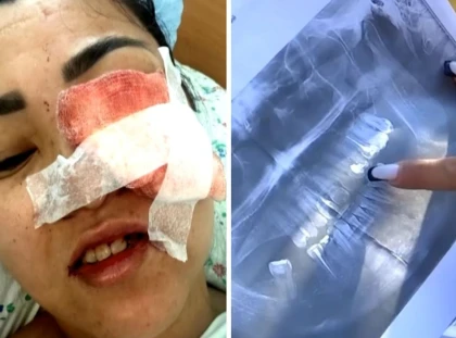 Ақтөбеде тіс дәрігеріне барған соң әйел балалы бола алмай қалды: Оған орта білімді дантист ем жүргізген