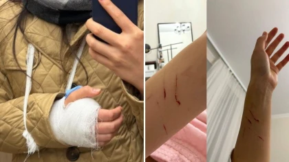 "21 күн қолым гипсте болады": Әділет министрлігінің қызметкері басшысын өзіне қол көтерді деп айыптады