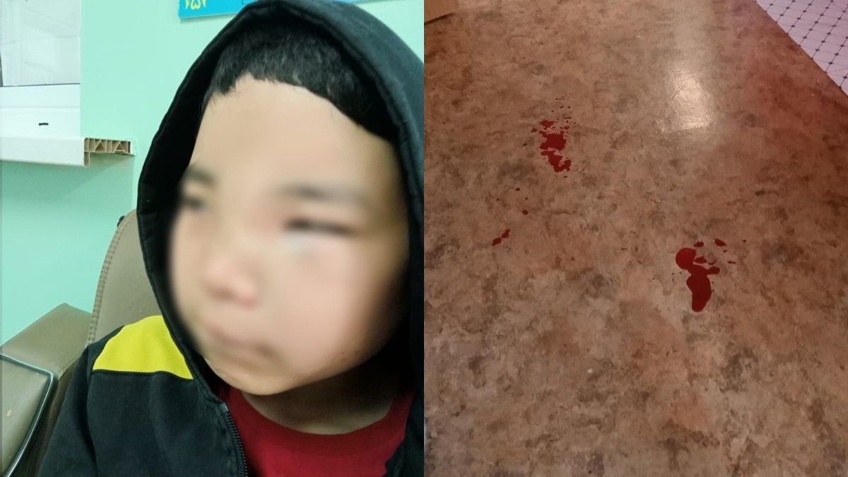 Қарау үшін әйелдердің жыныстық зорлық-зомбылығы