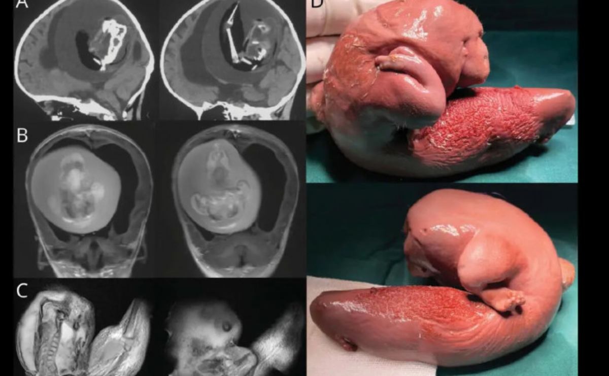 Порно икемді