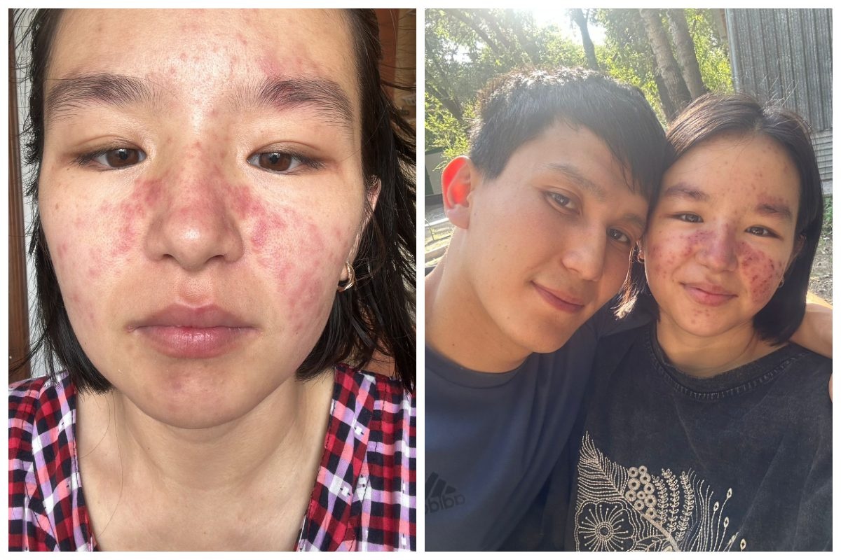 Менің түкті әйелімді есекке сиқтым