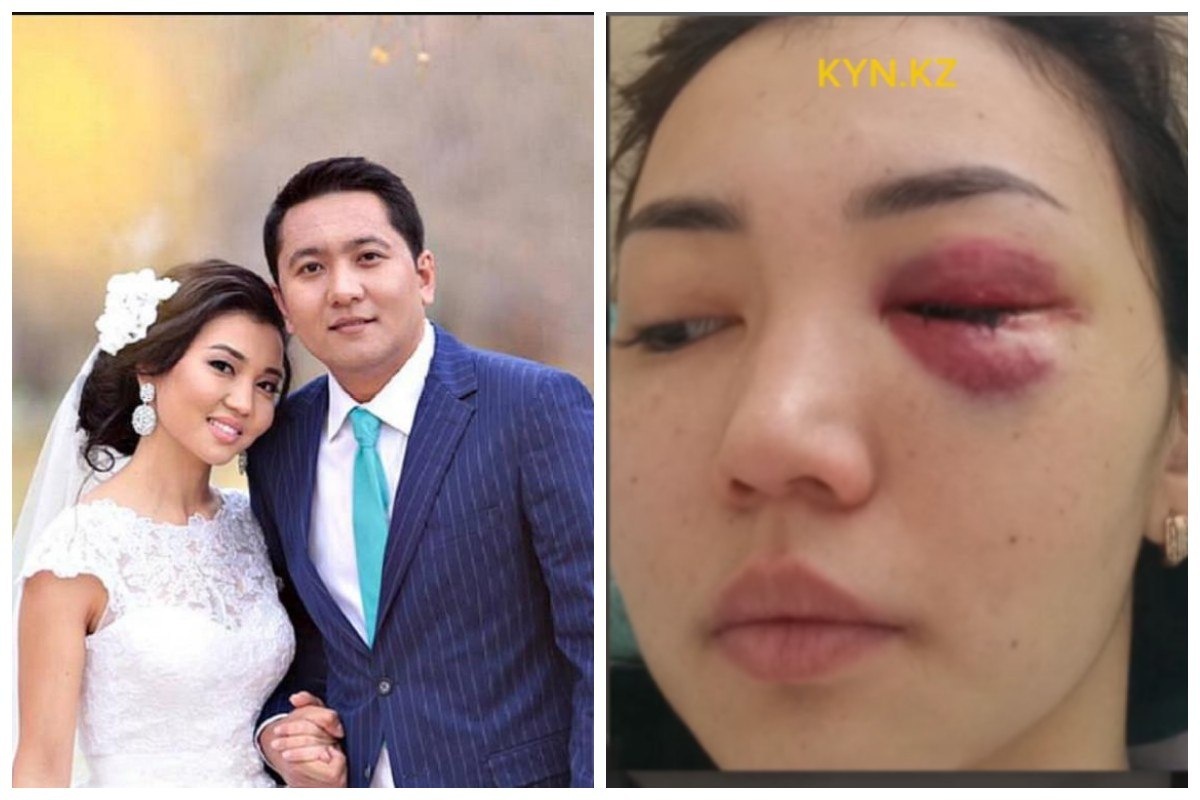 Үлкен емізік және әтештер