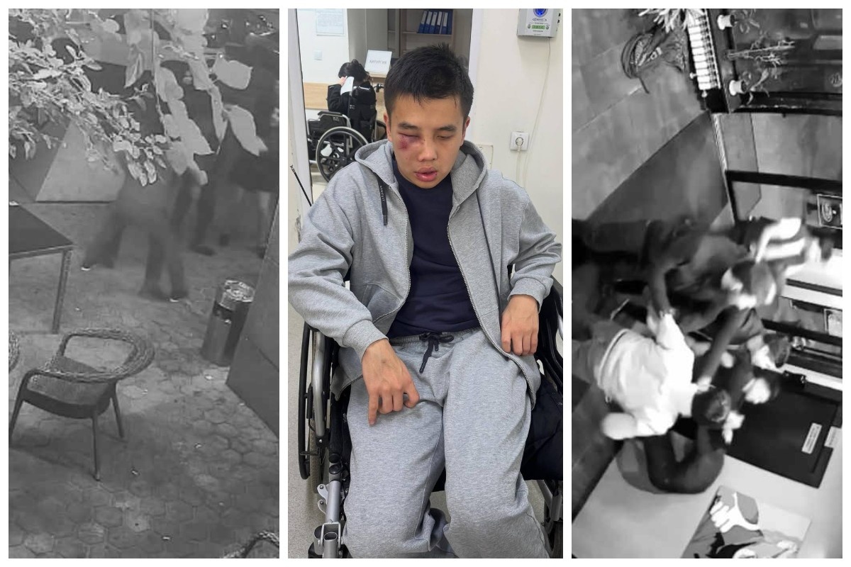 Жігіт анусын созады