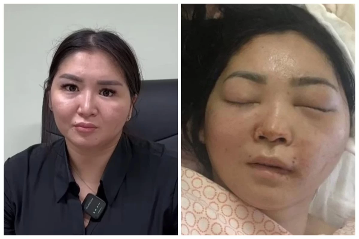 Күйеуі сабап, мүгедек болып қалған әйел сотталушының қоныс-колонияға ауыстырылғанына қарсы