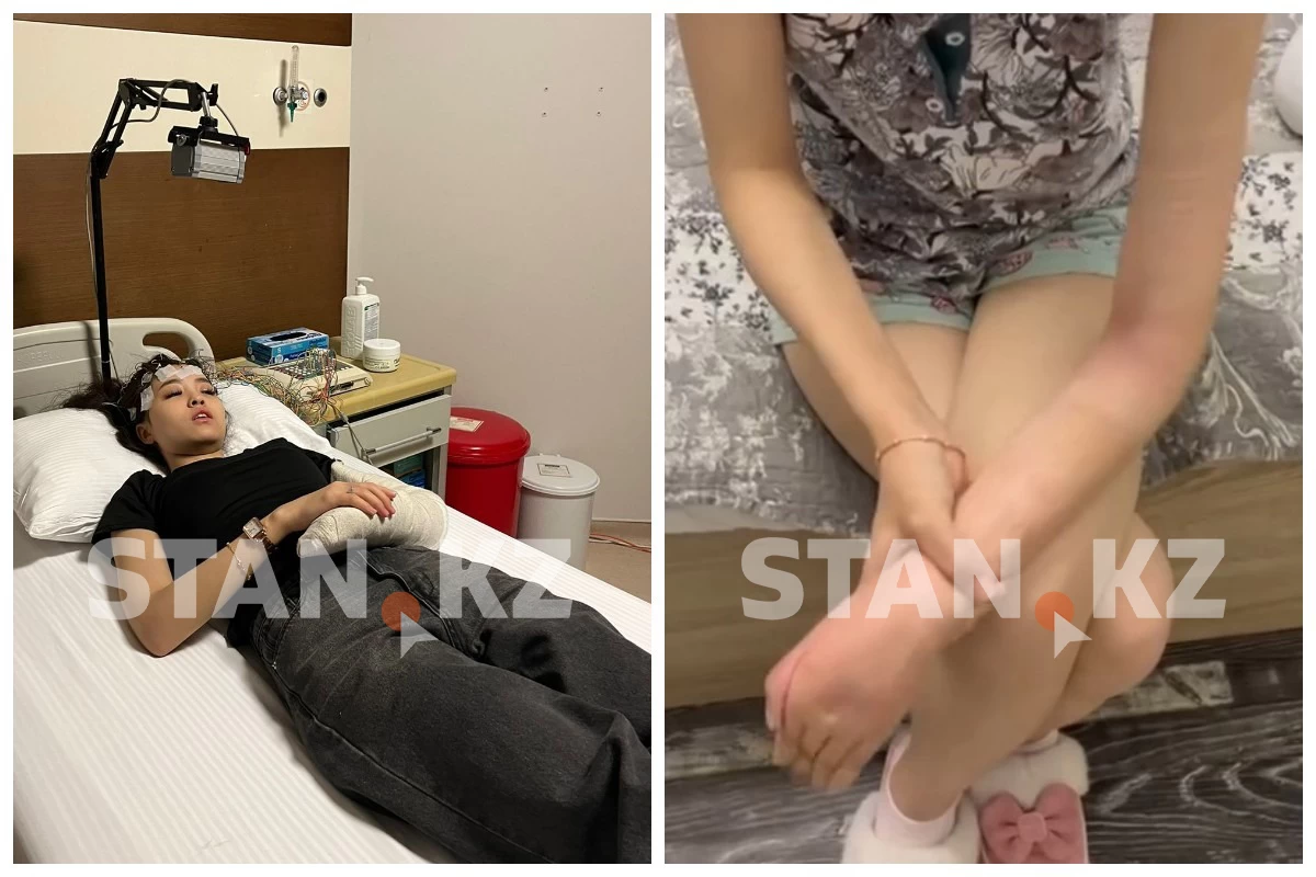 Алматыда самокат қағып кеткен жасөспірім мүгедек болып қалды