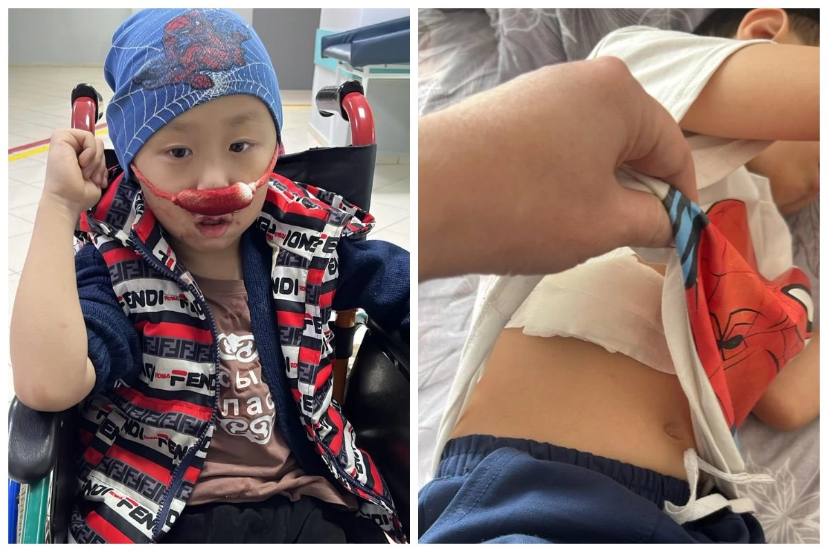 Министрлік пен қорлар бұлшықеті әлсіз қазақстандық бүлдіршінге көмек көрсетуден бас тартқан