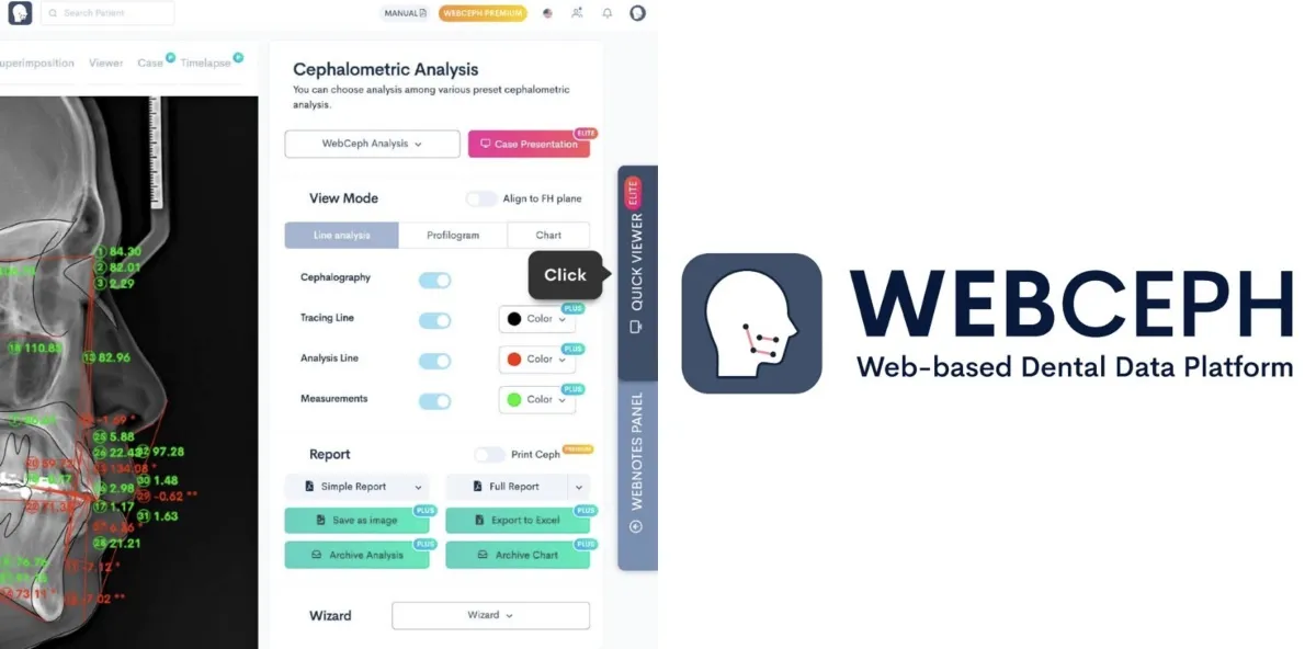 WebCeph