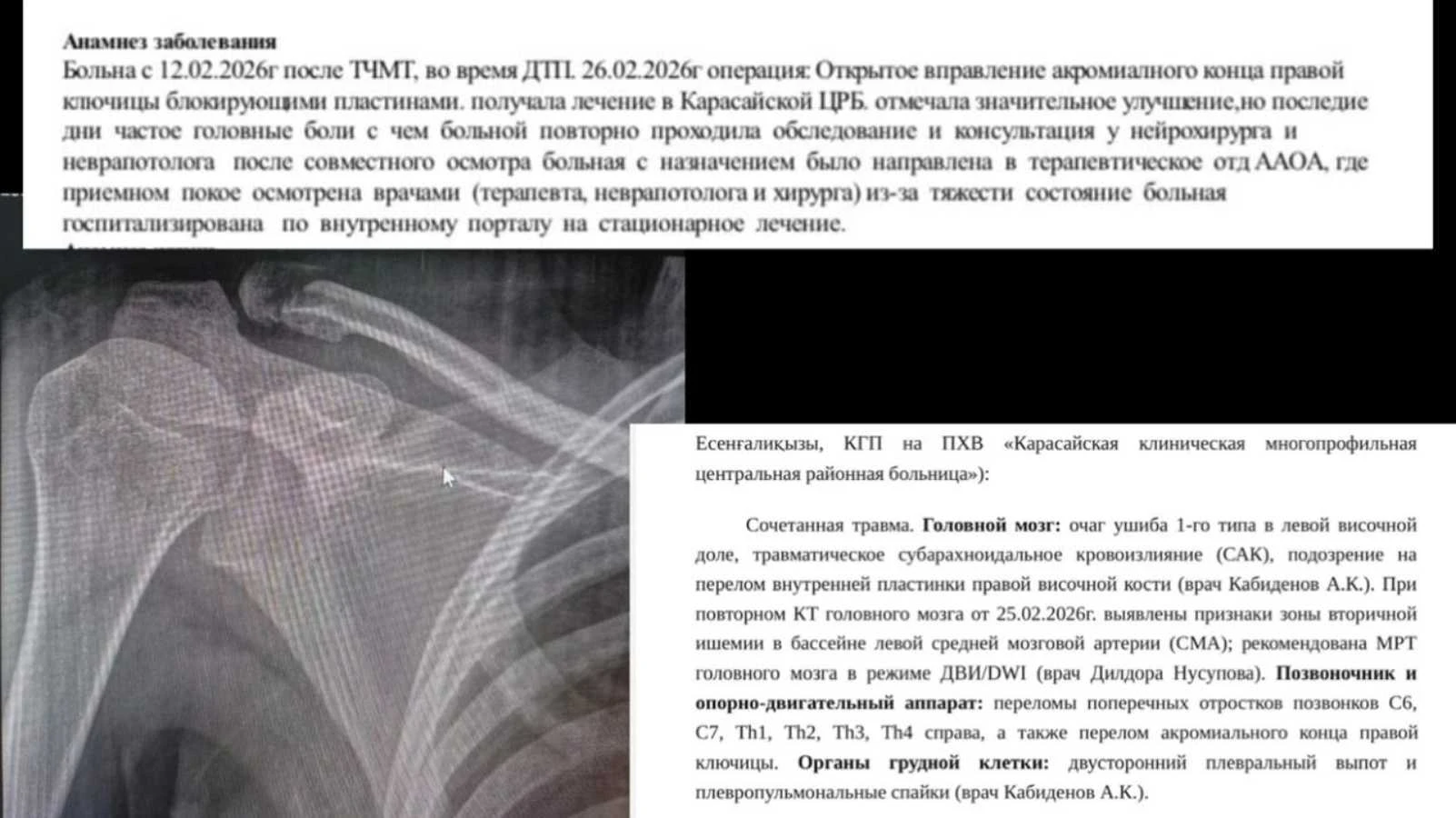 оооооо