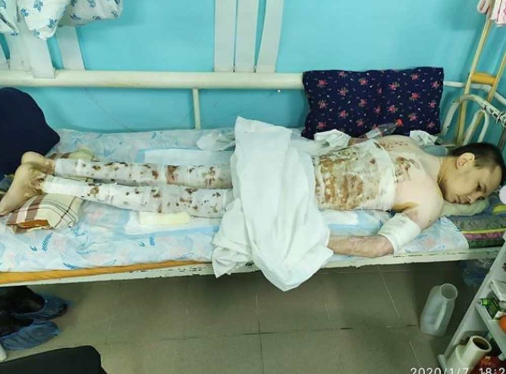 Ақтөбеде өзгені құтқарам деп күйік шалған жігіті 8 айдан бері ауруханада жатыр