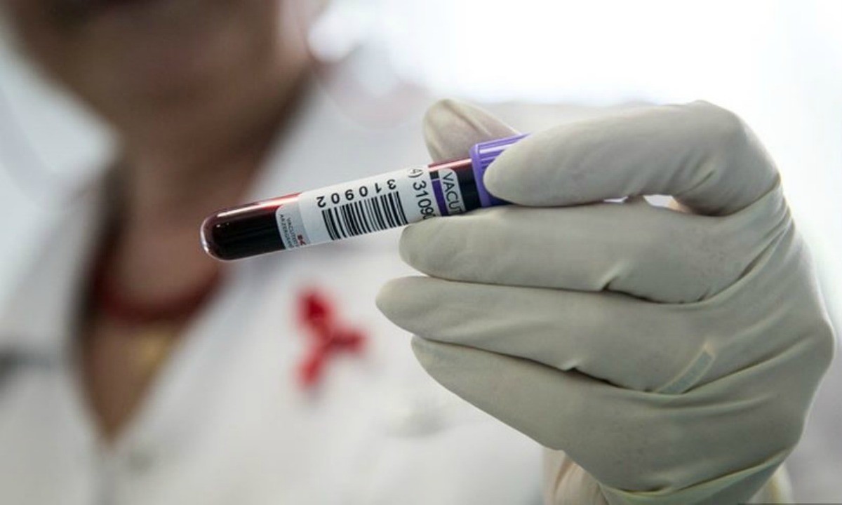 ВИЧ-ті толық емдеу мүмкін болды: Ғалымдар жаңа препарат жасап шығарды