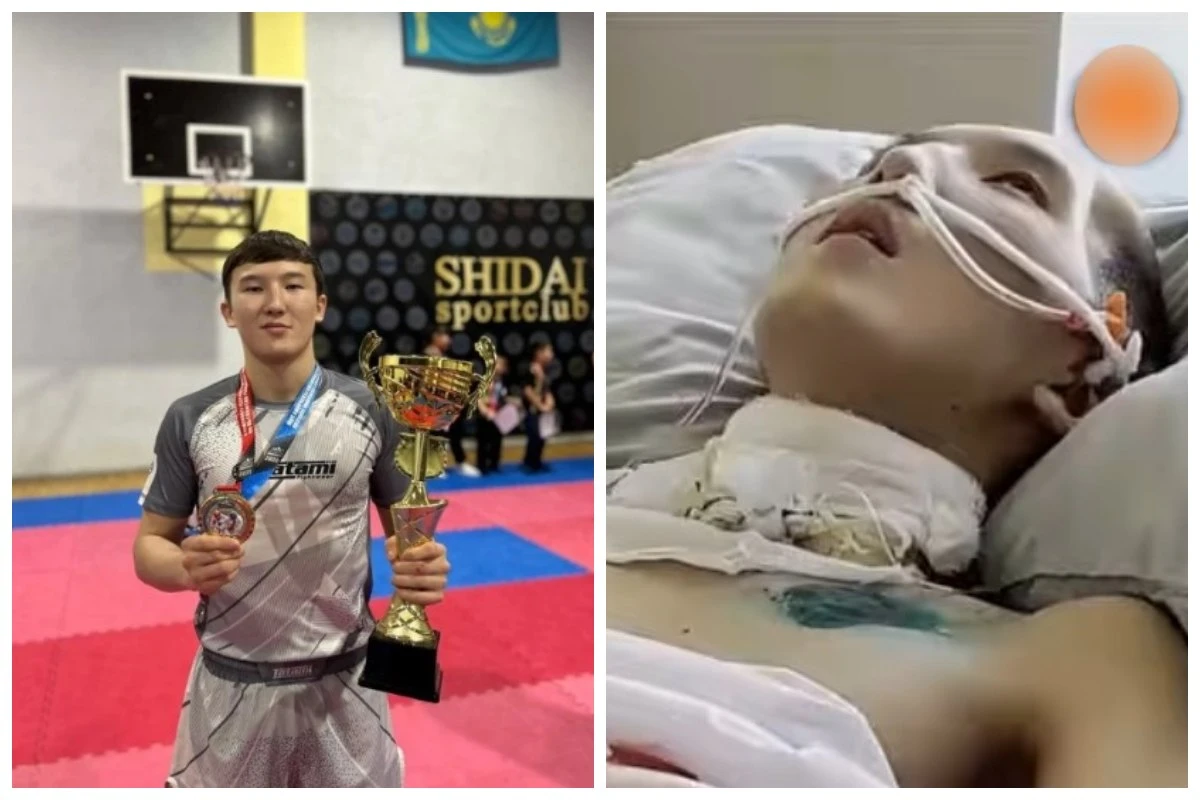 Рингте есін жоғалтқан спорты бір айдан соң комадан шықты