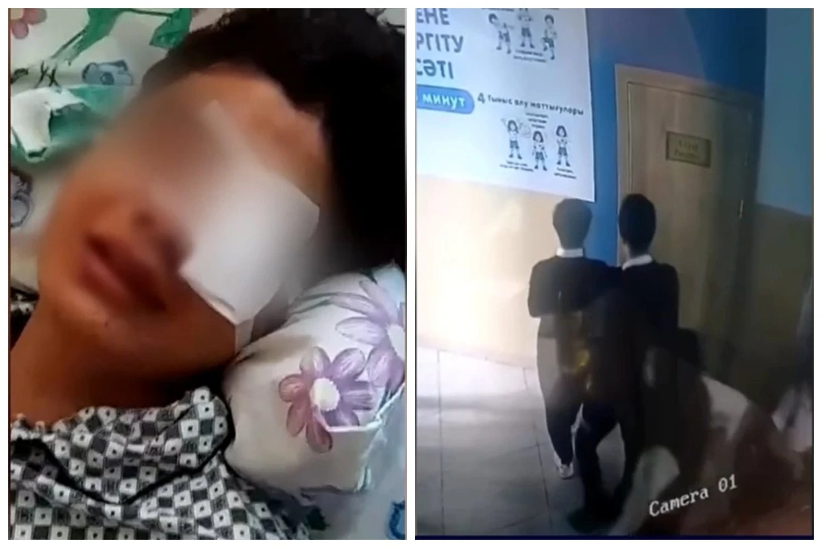 көзінен айырылған бала