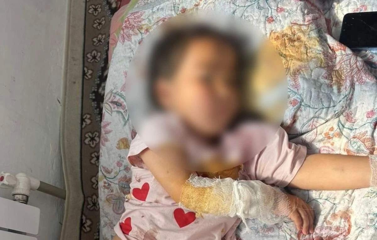 Қолы оралған кішкентай қыз