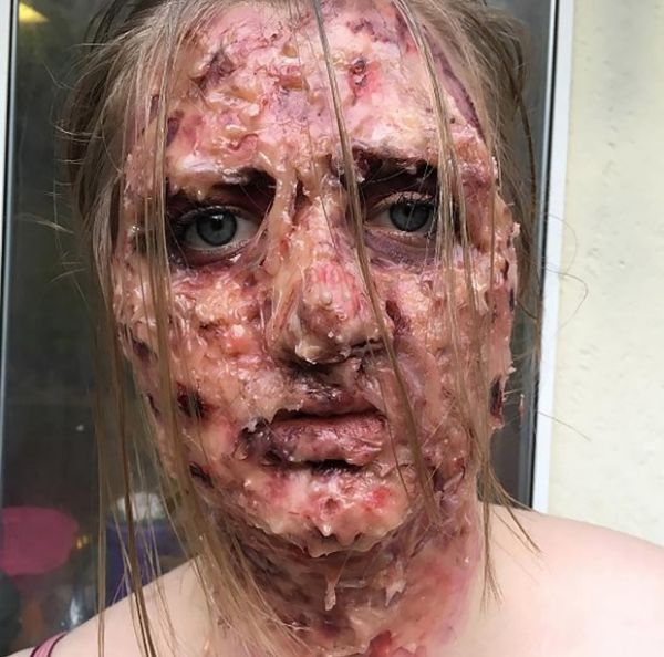 PIC FROM MERCURY PRESS (PICTURED: 17 YEAR OLD TIFFANY BAZE SHOWING OFF HER GORY MAKE UP SKILLS ) A teen creates amazing gory looks using make-up after experimenting with Halloween make-up. Tiffany Baze, from Willits, California, started playing with her mumís make-up when she was just 12 and loved experimenting with new looks. The 17-year-old stumbled on her hobby a couple of years ago after experimenting with fake blood and liquid latex at Halloween. When she first started posting her work on her social media, she received some nasty comments but says itís what she loves doing so doesnít let it bother her. Tiffany, who has just finished school and does special effects make-up full time, said: ìMost are positive saying they thought it was real or they really like it, but occasionally there will be a few people saying some nasty things to me. SEE MERCURY COPY